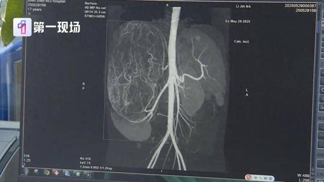 17岁女孩确诊癌症！买衣服时店员看出端倪……这个细节很重要！