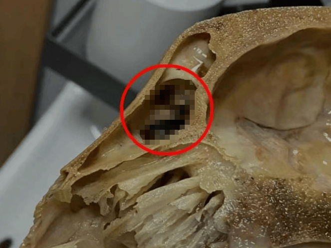 吃完发现全是蛆，恶心呕吐一整夜！上海法院判了：赔1000元